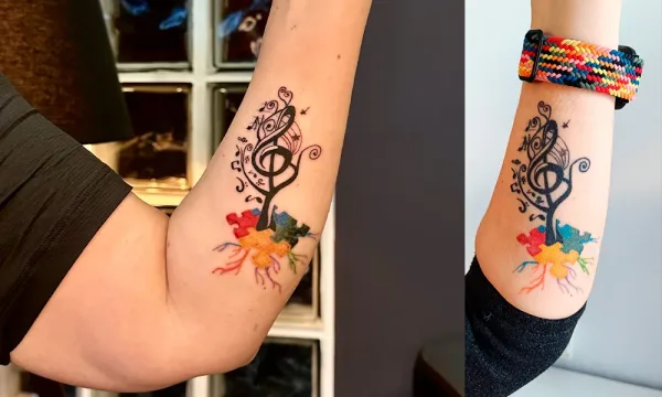 Before After Fineline Healed